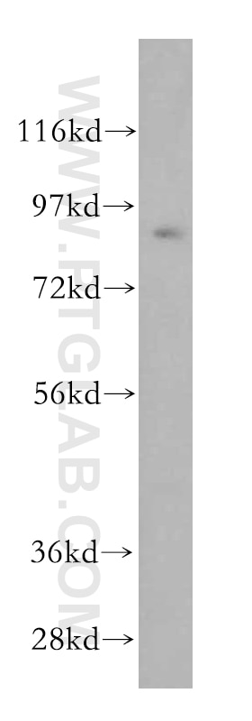 Western Blot (WB) analysis of Jurkat cells using UBA2 Polyclonal antibody (15347-1-AP)