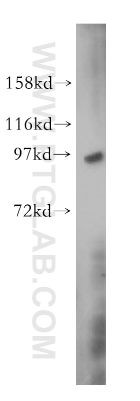 Western Blot (WB) analysis of human brain tissue using UBA2 Polyclonal antibody (15347-1-AP)