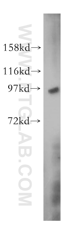 WB analysis of human brain using 15347-1-AP