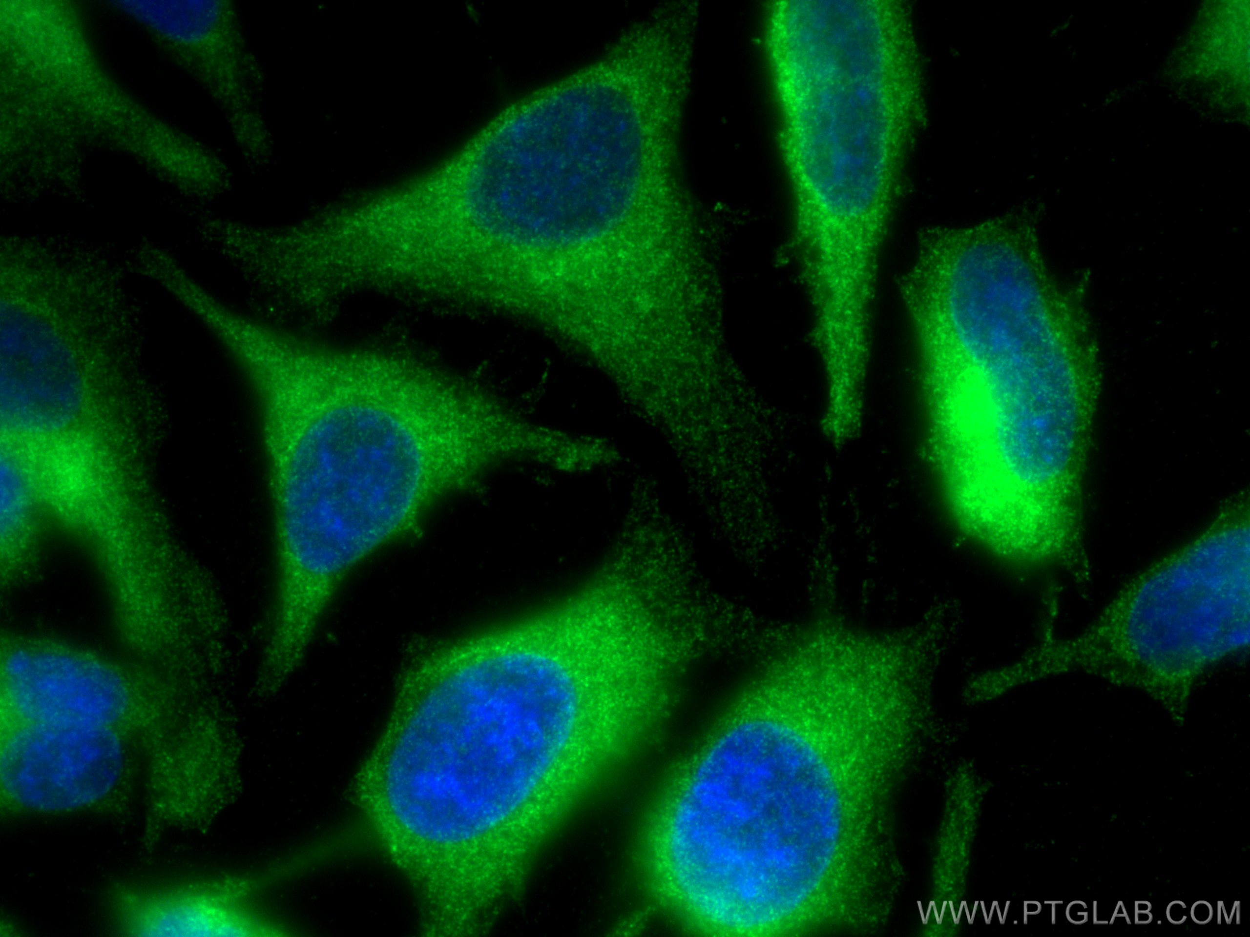 Immunofluorescence (IF) / fluorescent staining of HeLa cells using UBA5 Polyclonal antibody (12093-1-AP)