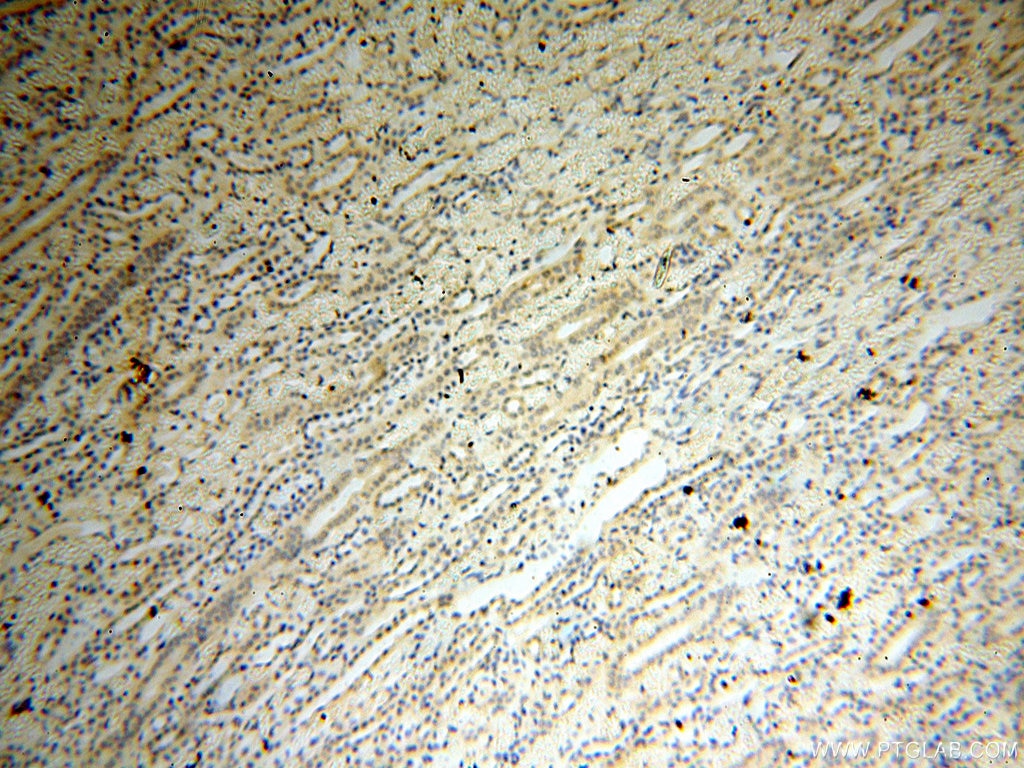 Immunohistochemistry (IHC) staining of human kidney tissue using UBA52 Polyclonal antibody (18039-1-AP)