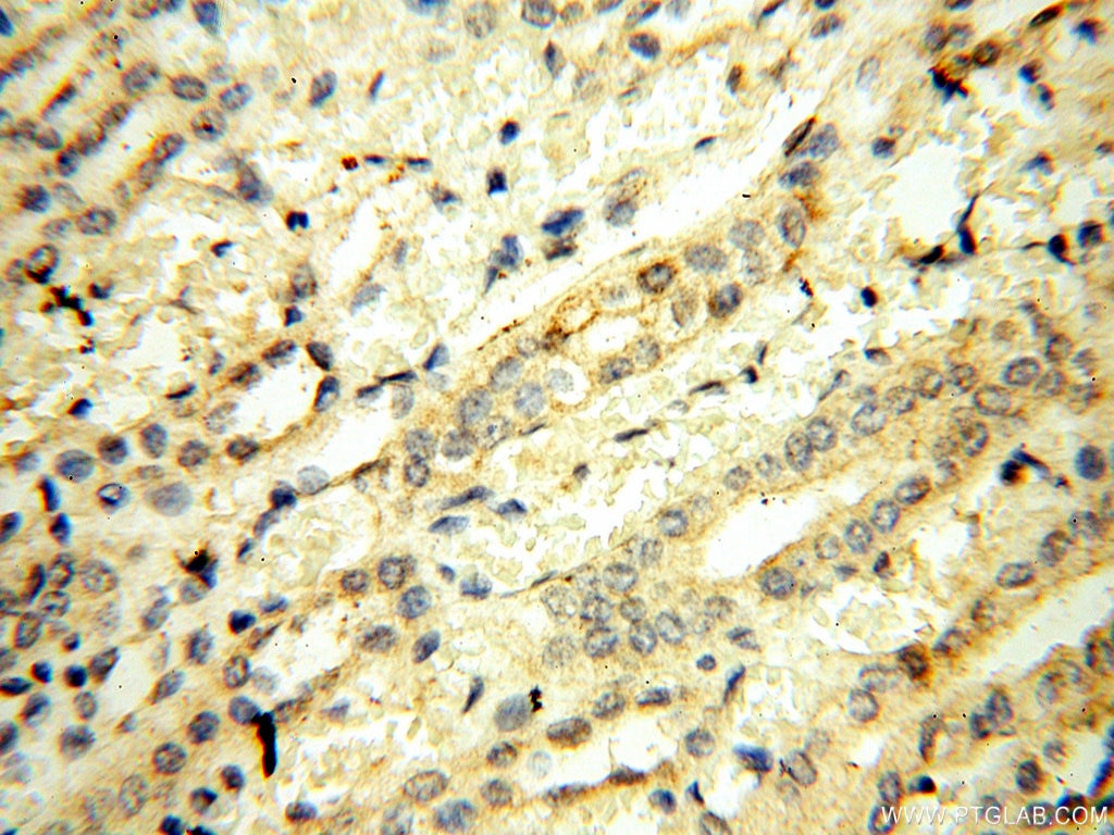 Immunohistochemistry (IHC) staining of human kidney tissue using UBA52 Polyclonal antibody (18039-1-AP)