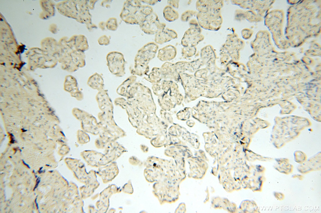 Immunohistochemistry (IHC) staining of human placenta tissue using UBA52 Polyclonal antibody (18039-1-AP)