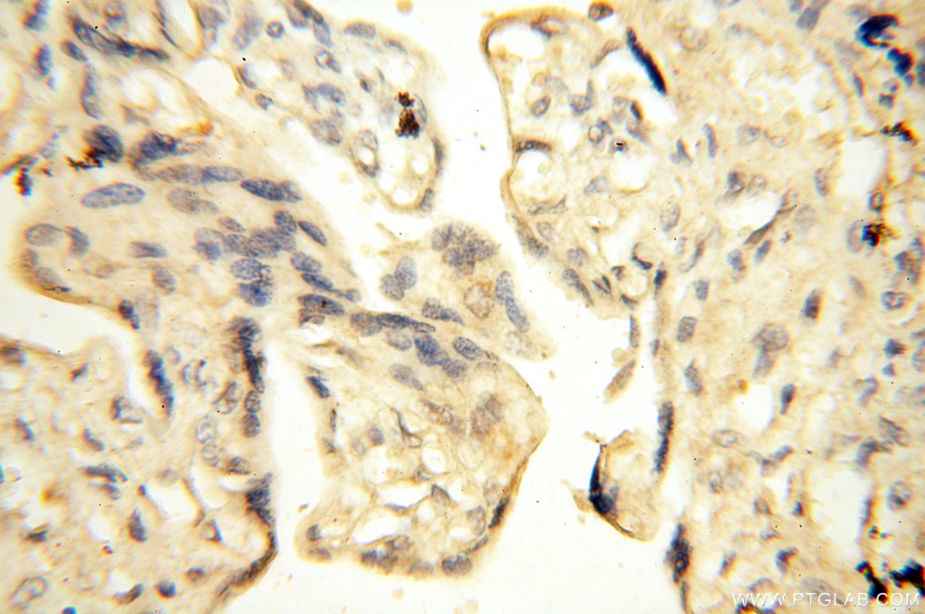 Immunohistochemistry (IHC) staining of human placenta tissue using UBA52 Polyclonal antibody (18039-1-AP)