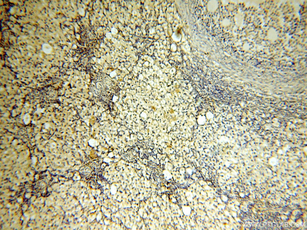 Immunohistochemistry (IHC) staining of human ovary tissue using UBA52 Polyclonal antibody (18039-1-AP)