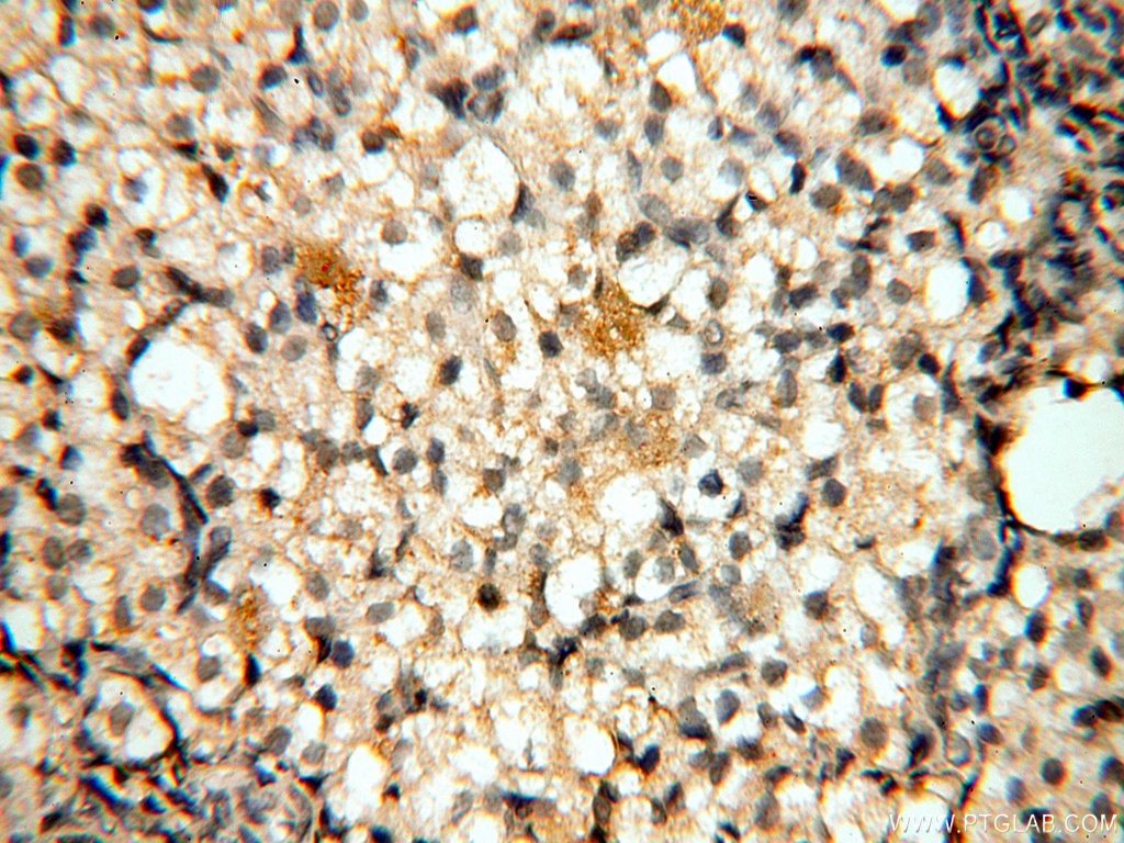 Immunohistochemistry (IHC) staining of human ovary tissue using UBA52 Polyclonal antibody (18039-1-AP)