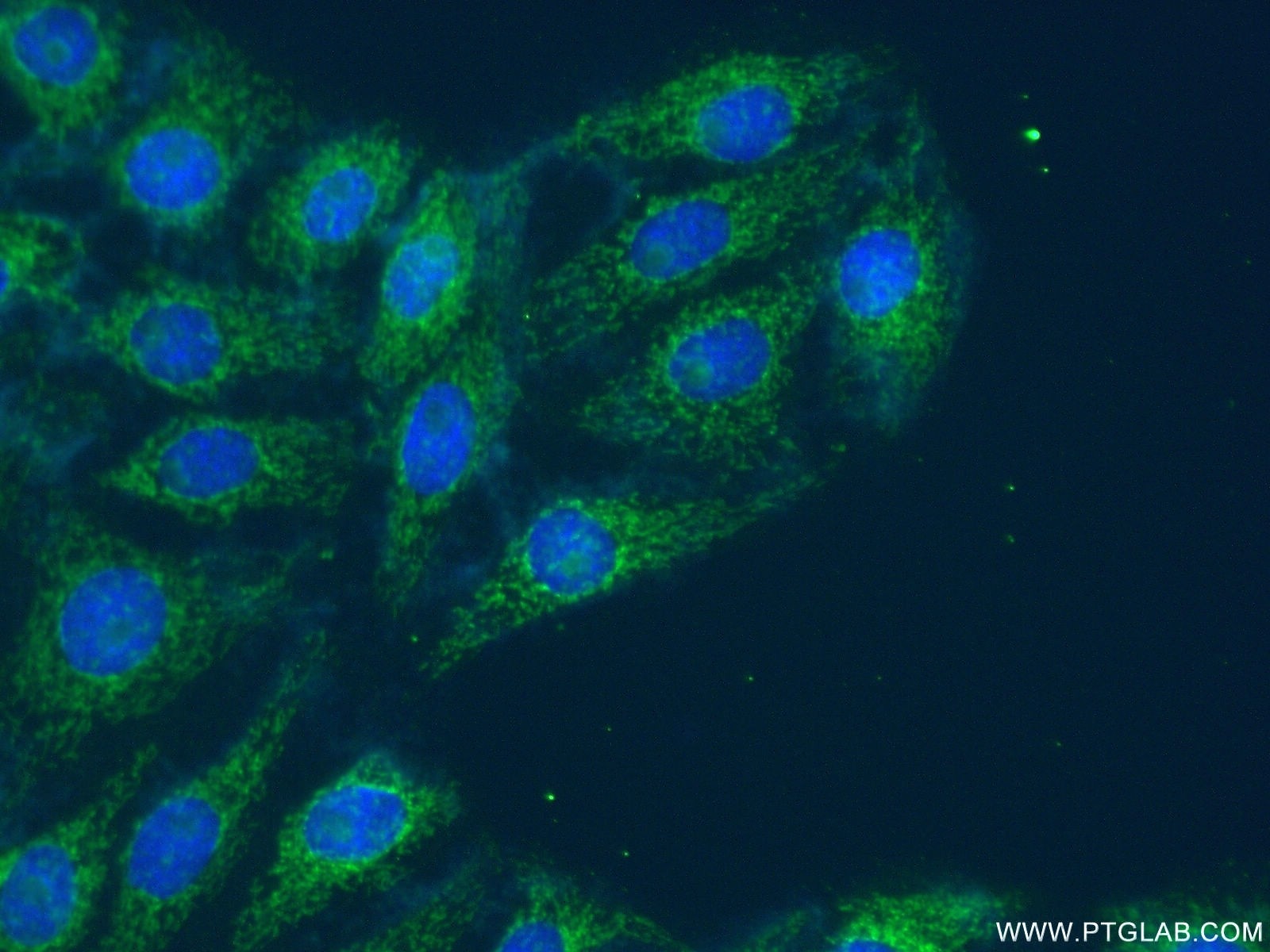 Immunofluorescence (IF) / fluorescent staining of SH-SY5Y cells using UBA6 Polyclonal antibody (13211-1-AP)