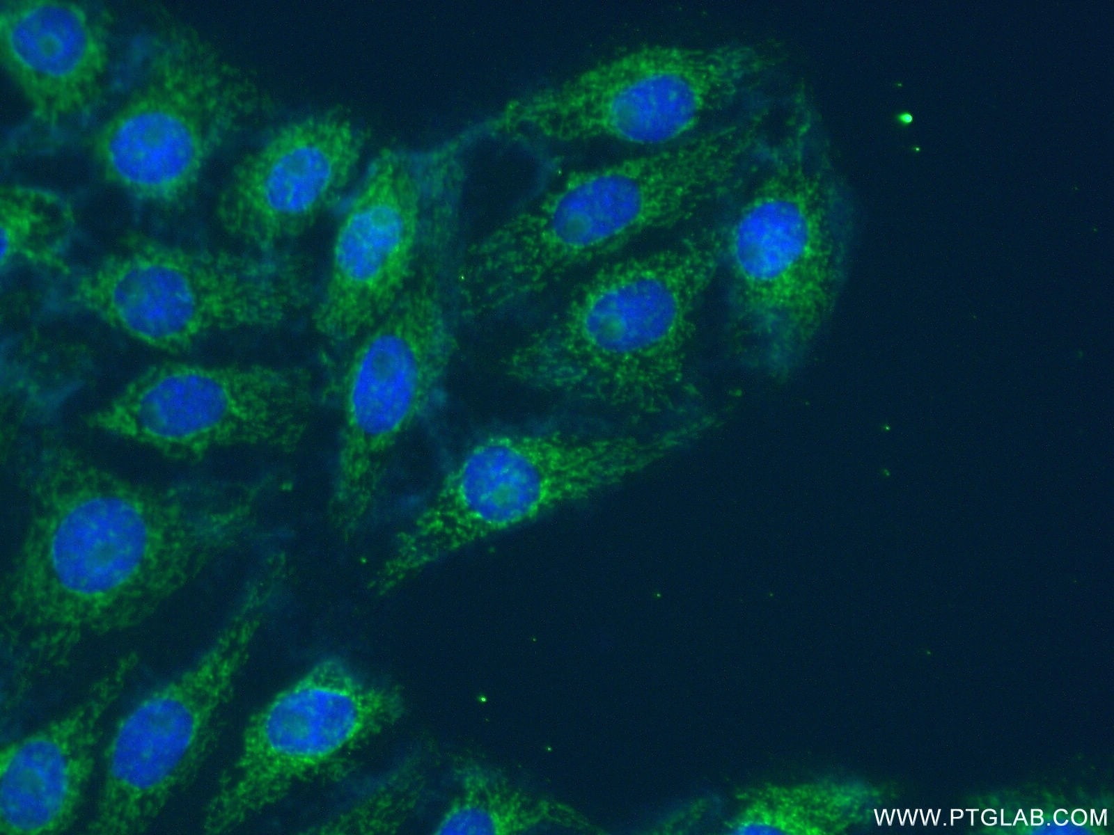 IF Staining of SH-SY5Y using 13211-1-AP