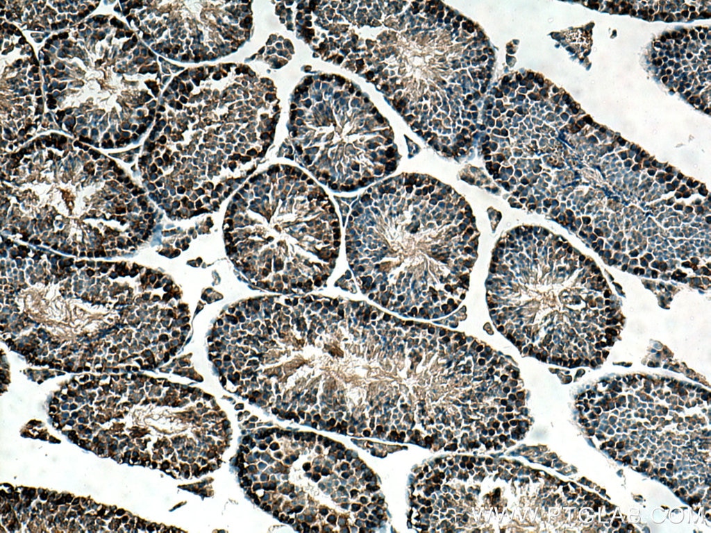 Immunohistochemistry (IHC) staining of mouse testis tissue using UBA6 Polyclonal antibody (13211-1-AP)