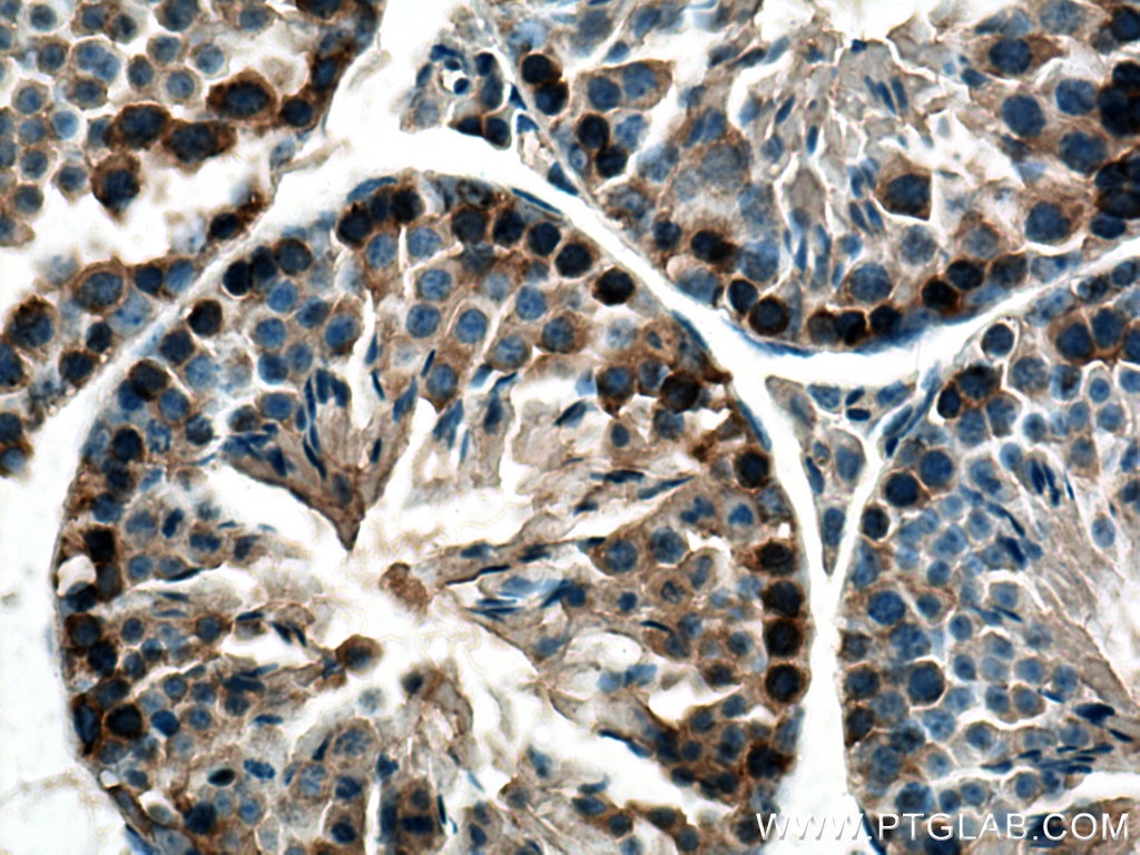Immunohistochemistry (IHC) staining of mouse testis tissue using UBA6 Polyclonal antibody (13211-1-AP)