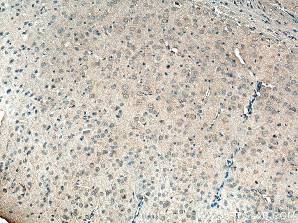 Immunohistochemistry (IHC) staining of mouse brain tissue using UBA6 Polyclonal antibody (13211-1-AP)