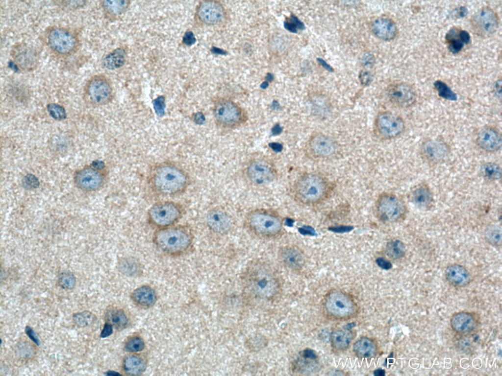 Immunohistochemistry (IHC) staining of mouse brain tissue using UBA6 Polyclonal antibody (13211-1-AP)