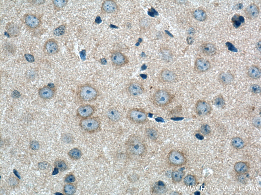 IHC staining of mouse brain using 13211-1-AP