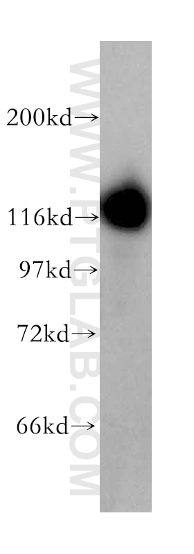 Western Blot (WB) analysis of human brain tissue using UBA6 Polyclonal antibody (13211-1-AP)