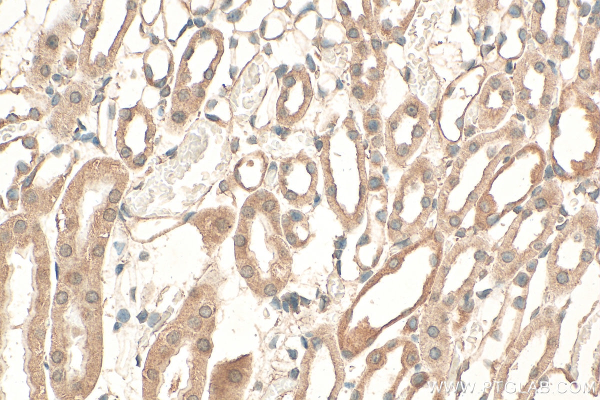 Immunohistochemistry (IHC) staining of mouse kidney tissue using UBE1L Polyclonal antibody (15818-1-AP)