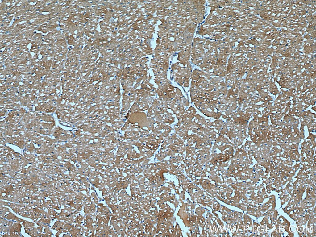 IHC staining of human heart using 19844-1-AP