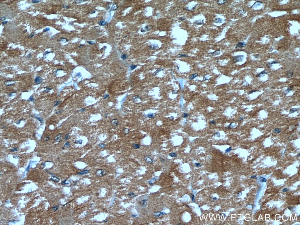 IHC staining of human heart using 19844-1-AP