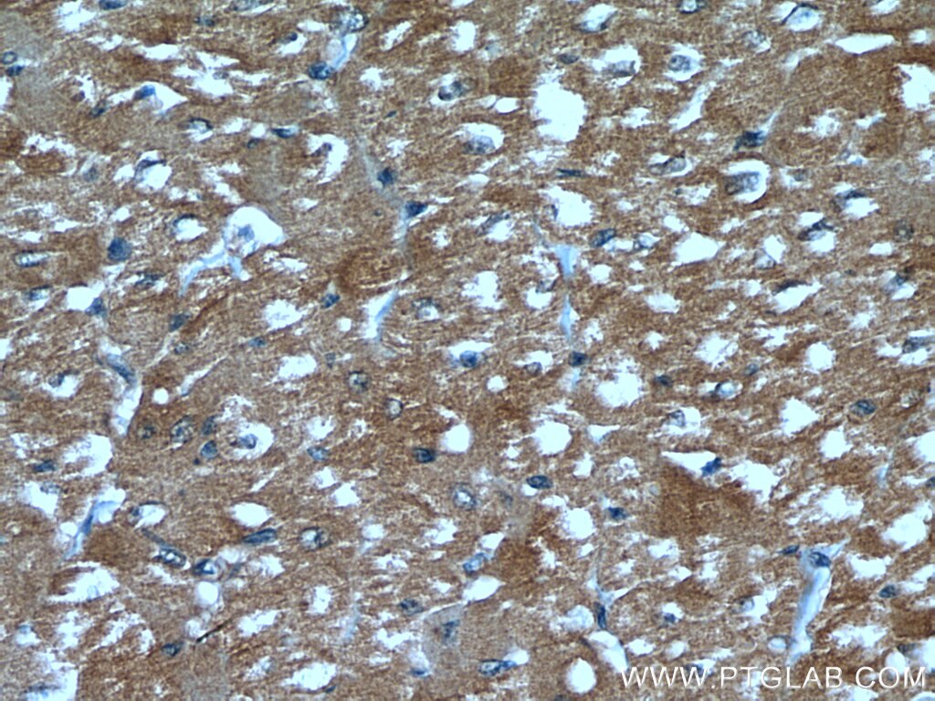 Immunohistochemistry (IHC) staining of human heart tissue using UBAC1 Polyclonal antibody (19844-1-AP)