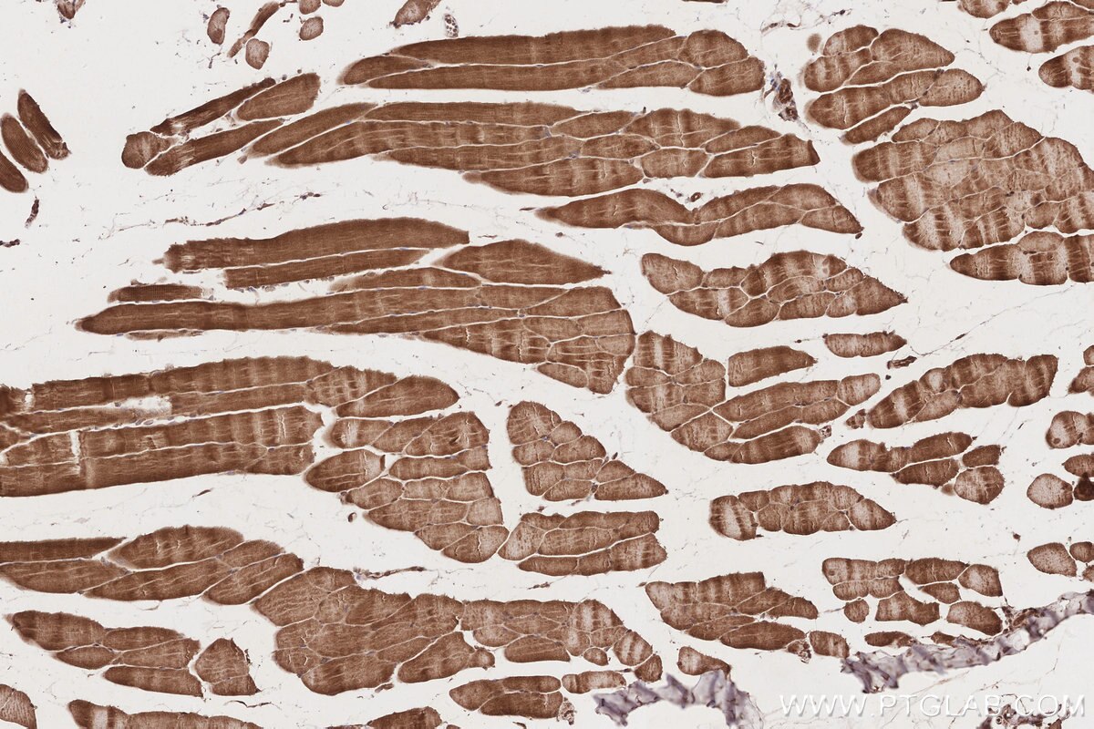 IHC staining of mouse skeletal muscle using 19844-1-AP Immunohistochemistry (IHC) staining of mouse skeletal muscle tissue using UBAC1 Polyclonal antibody (19844-1-AP)