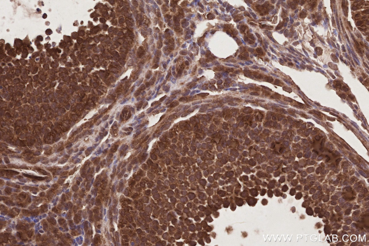IHC staining of mouse ovary using 19844-1-AP Immunohistochemistry (IHC) staining of mouse ovary tissue using UBAC1 Polyclonal antibody (19844-1-AP)