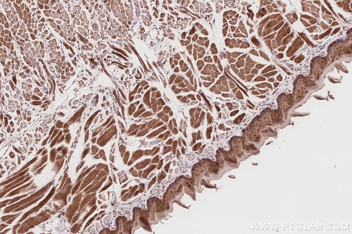 IHC staining of mouse tongue using 19844-1-AP Immunohistochemistry (IHC) staining of mouse tongue tissue using UBAC1 Polyclonal antibody (19844-1-AP)