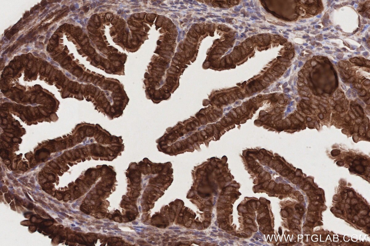 IHC staining of mouse ovary using 19844-1-AP Immunohistochemistry (IHC) staining of mouse ovary tissue using UBAC1 Polyclonal antibody (19844-1-AP)