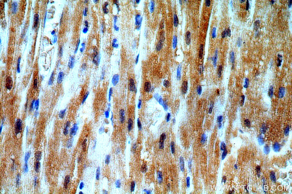 Immunohistochemistry (IHC) staining of human heart tissue using UBAC1 Polyclonal antibody (19844-1-AP)
