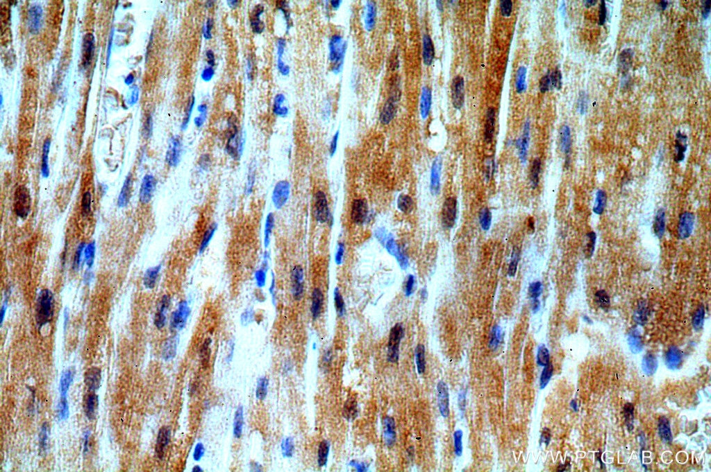 IHC staining of human heart using 19844-1-AP