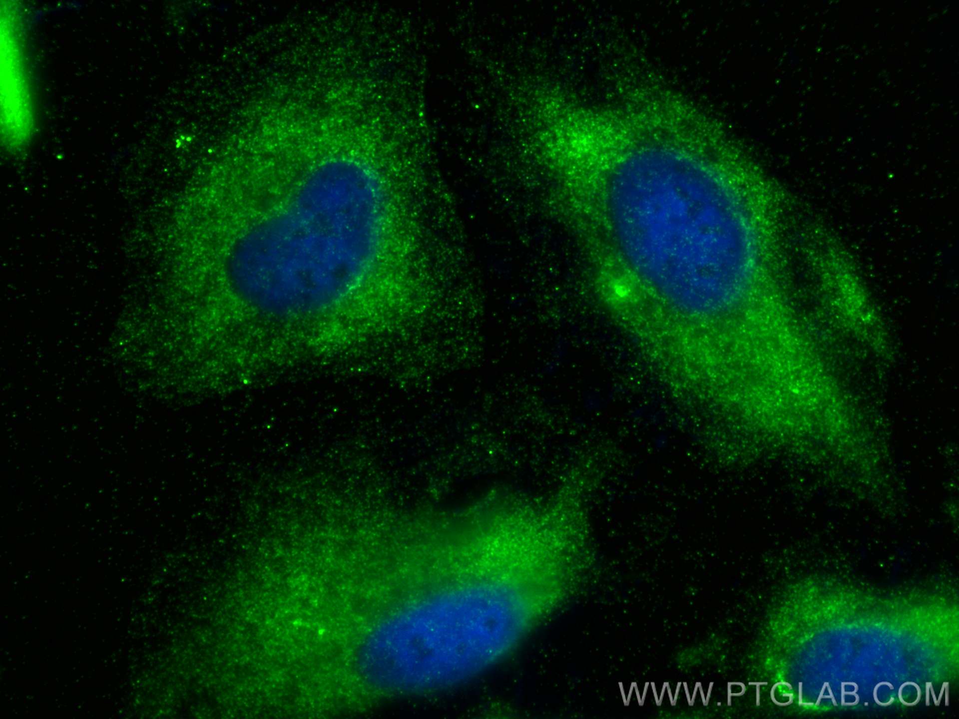 Immunofluorescence (IF) / fluorescent staining of HeLa cells using UBAC1 Monoclonal antibody (67385-1-Ig)