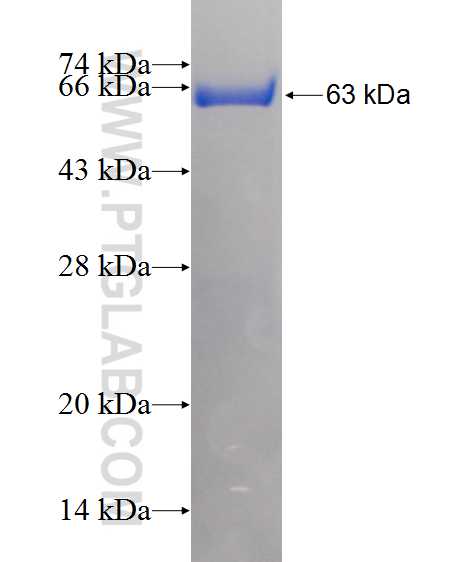 UBAC1 fusion protein Ag13887 SDS-PAGE