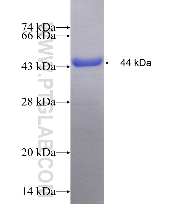 UBAC1 fusion protein Ag13958 SDS-PAGE