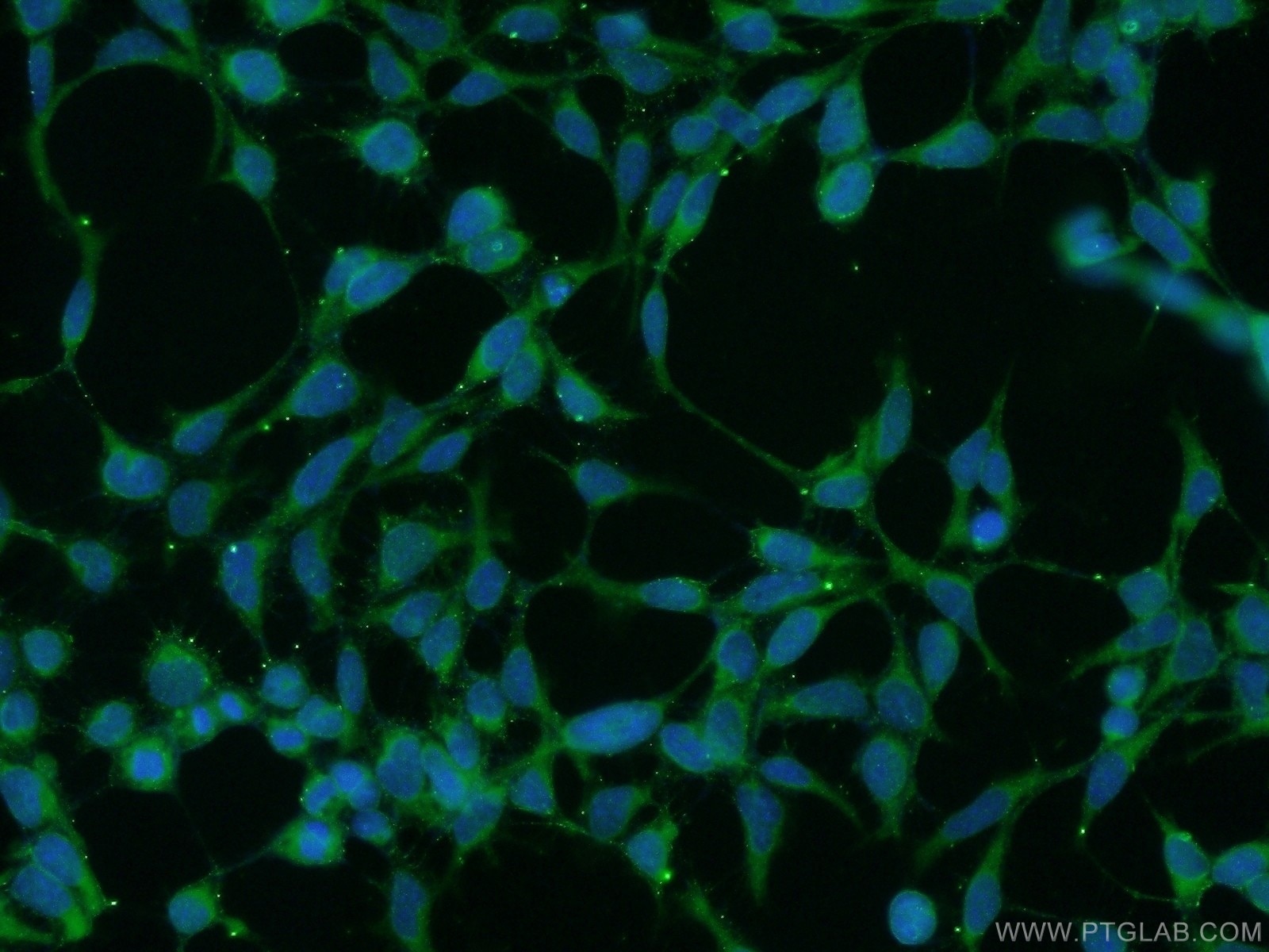 Immunofluorescence (IF) / fluorescent staining of HEK-293 cells using UBAC2 Polyclonal antibody (25122-1-AP)