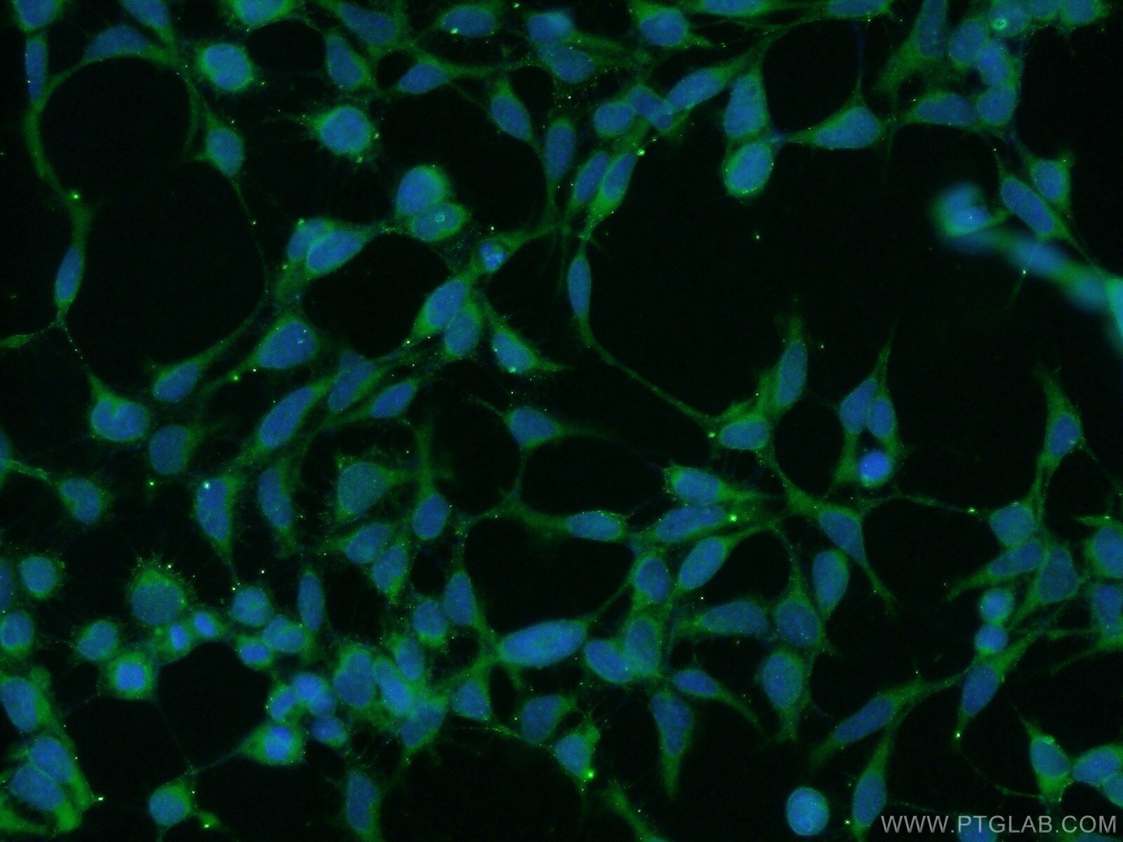 IF Staining of HEK-293 using 25122-1-AP