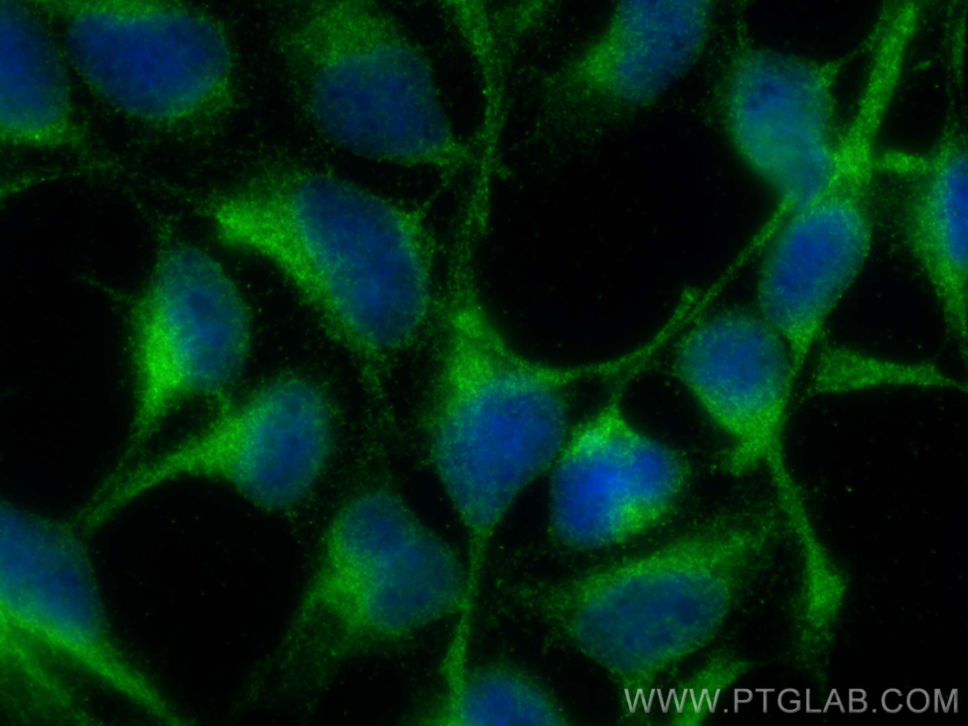 Immunofluorescence (IF) / fluorescent staining of HEK-293 cells using UBAC2 Polyclonal antibody (25122-1-AP)