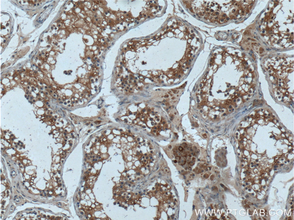 Immunohistochemistry (IHC) staining of human testis tissue using UBAC2 Polyclonal antibody (25122-1-AP)