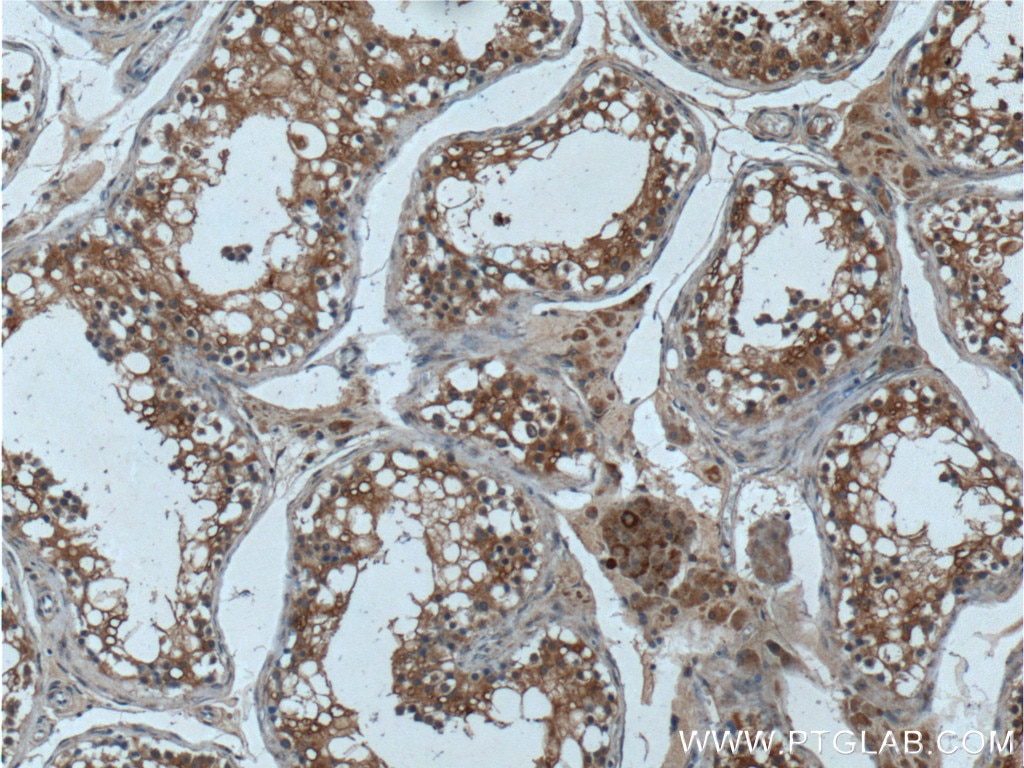 IHC staining of human testis using 25122-1-AP