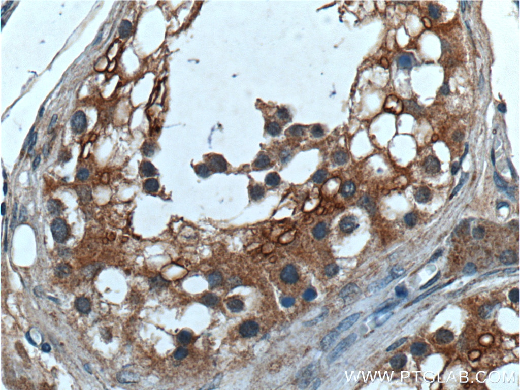 Immunohistochemistry (IHC) staining of human testis tissue using UBAC2 Polyclonal antibody (25122-1-AP)