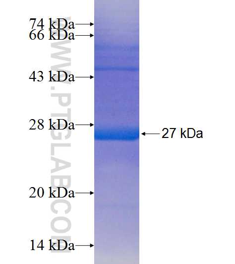 UBAC2 fusion protein Ag19142 SDS-PAGE