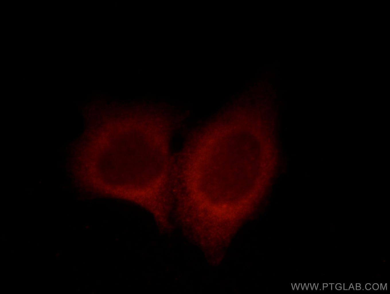 Immunofluorescence (IF) / fluorescent staining of HeLa cells using UBAP1 Polyclonal antibody (12385-1-AP)
