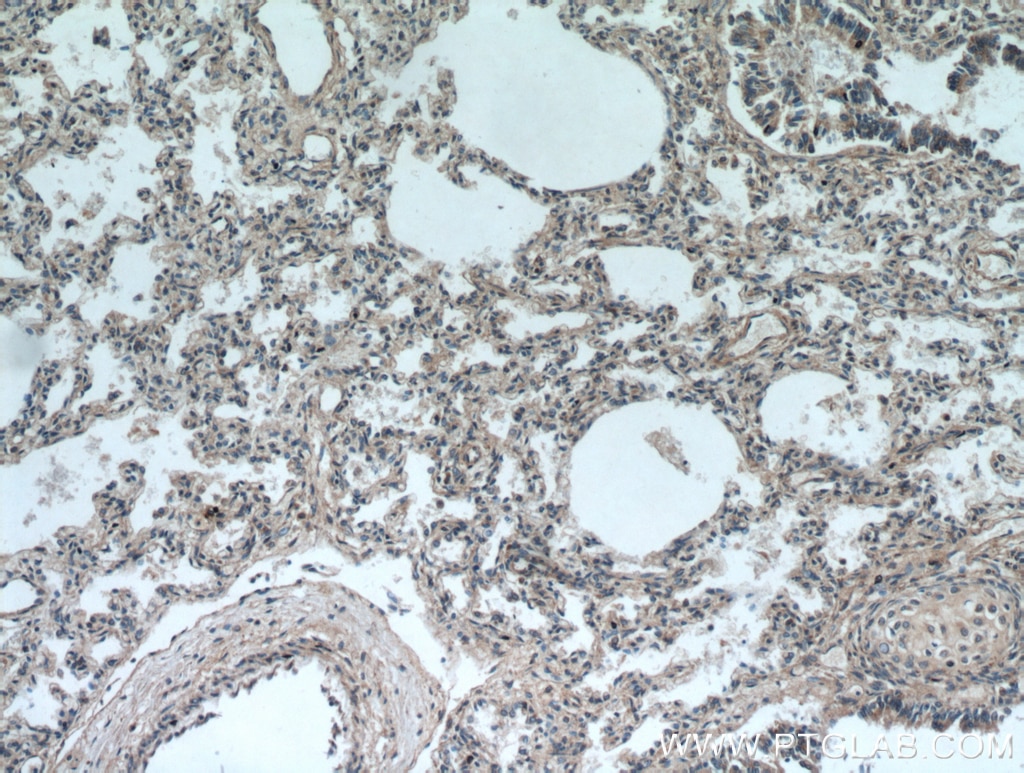 Immunohistochemistry (IHC) staining of human lung tissue using UBAP1 Polyclonal antibody (12385-1-AP)