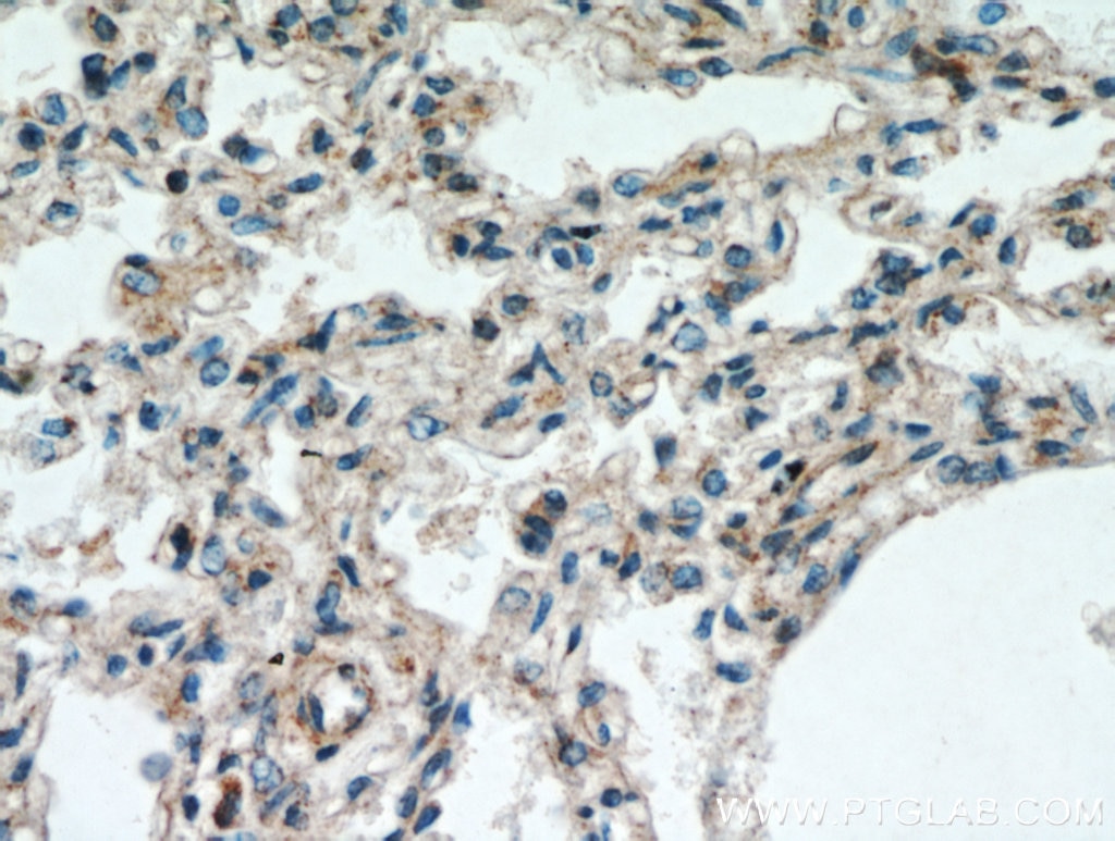 IHC staining of human lung using 12385-1-AP