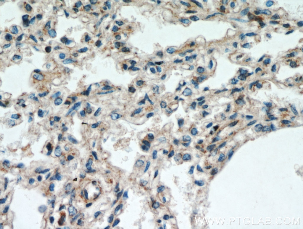 Immunohistochemistry (IHC) staining of human lung tissue using UBAP1 Polyclonal antibody (12385-1-AP)