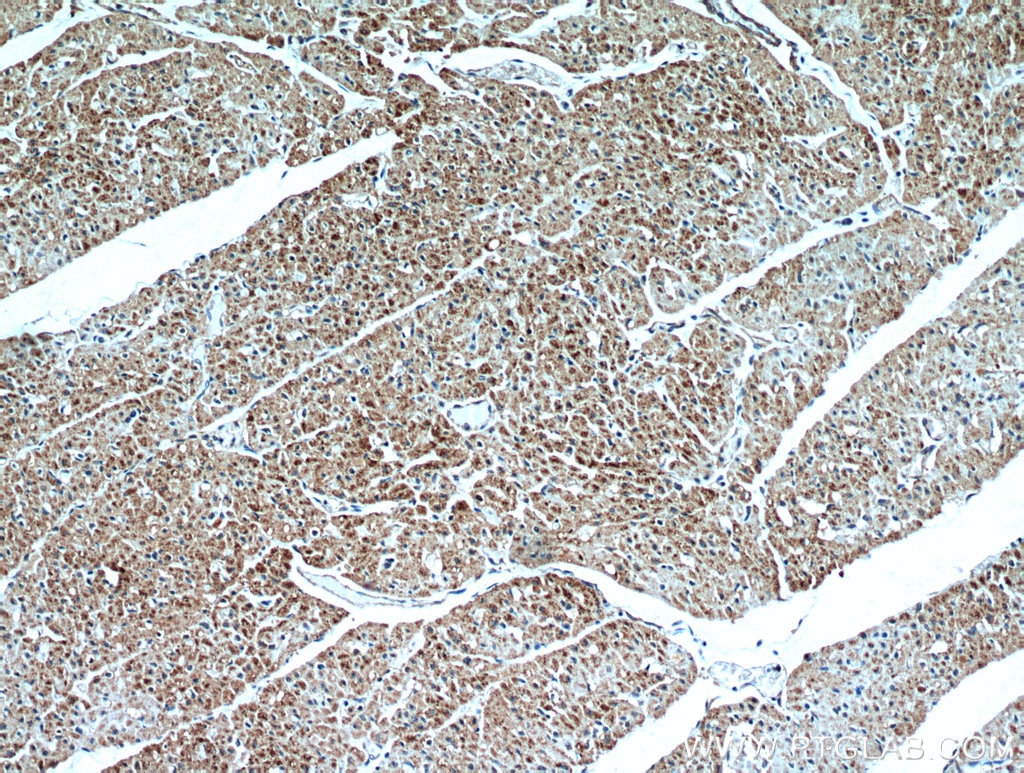 Immunohistochemistry (IHC) staining of human heart tissue using UBAP1 Polyclonal antibody (12385-1-AP)