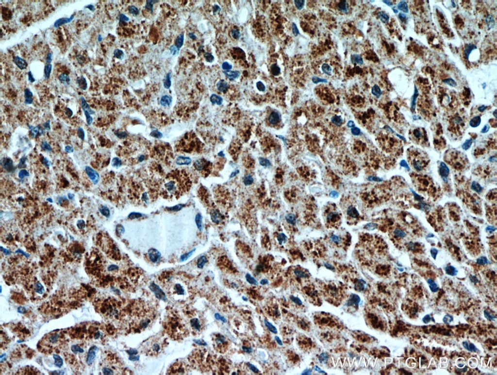 Immunohistochemistry (IHC) staining of human heart tissue using UBAP1 Polyclonal antibody (12385-1-AP)