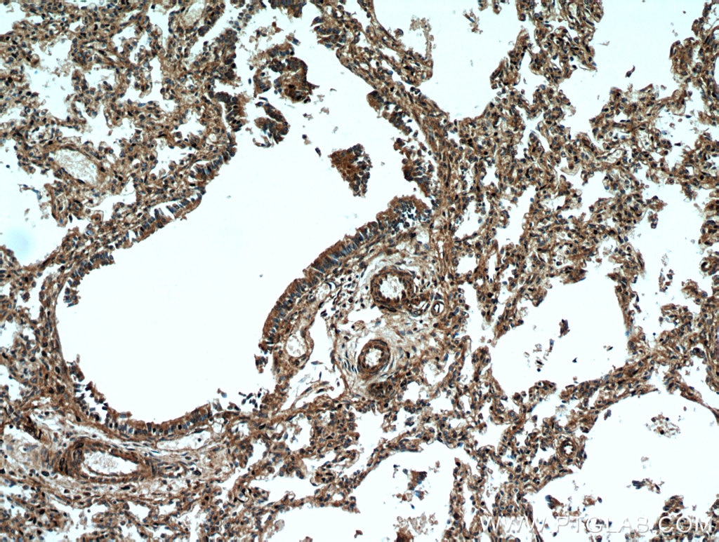 Immunohistochemistry (IHC) staining of human lung tissue using UBAP1 Polyclonal antibody (12385-1-AP)