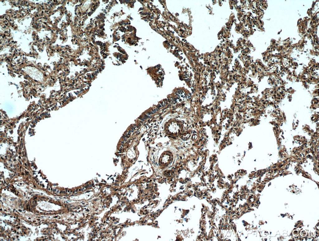 IHC staining of human lung using 12385-1-AP