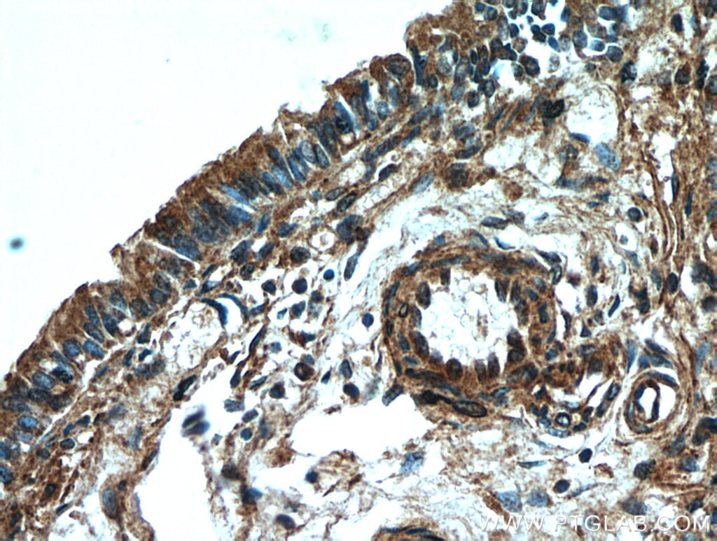 Immunohistochemistry (IHC) staining of human lung tissue using UBAP1 Polyclonal antibody (12385-1-AP)