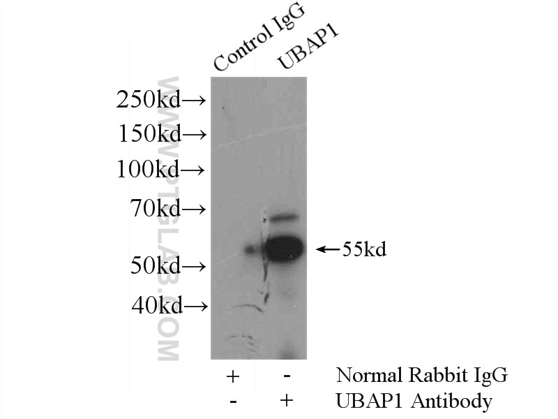 Immunoprecipitation (IP) experiment of mouse brain tissue using UBAP1 Polyclonal antibody (12385-1-AP)