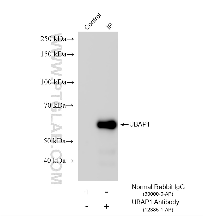 IP experiment of mouse brain using 12385-1-AP Immunoprecipitation (IP) experiment of mouse brain tissue using UBAP1 Polyclonal antibody (12385-1-AP)