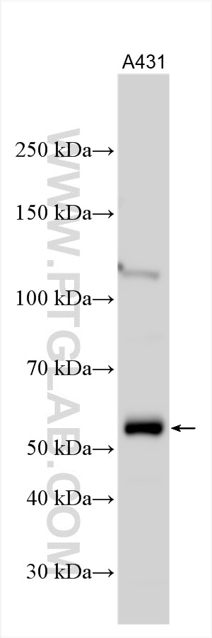 Western Blot (WB) analysis of various lysates using UBAP1 Polyclonal antibody (12385-1-AP)
